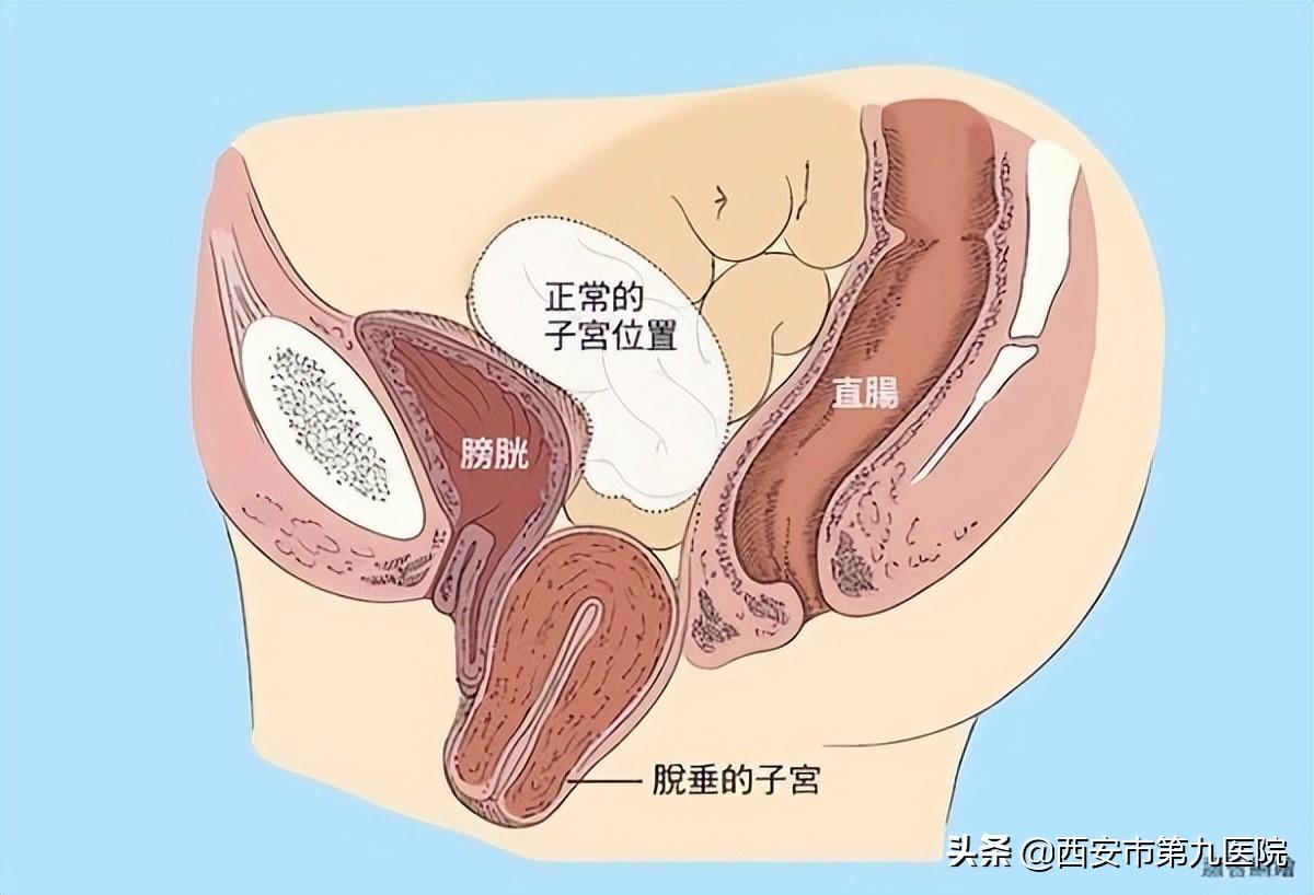 睪丸下垂松弛的原因及治療方法，睪丸下垂松弛的原因與治療方法解析