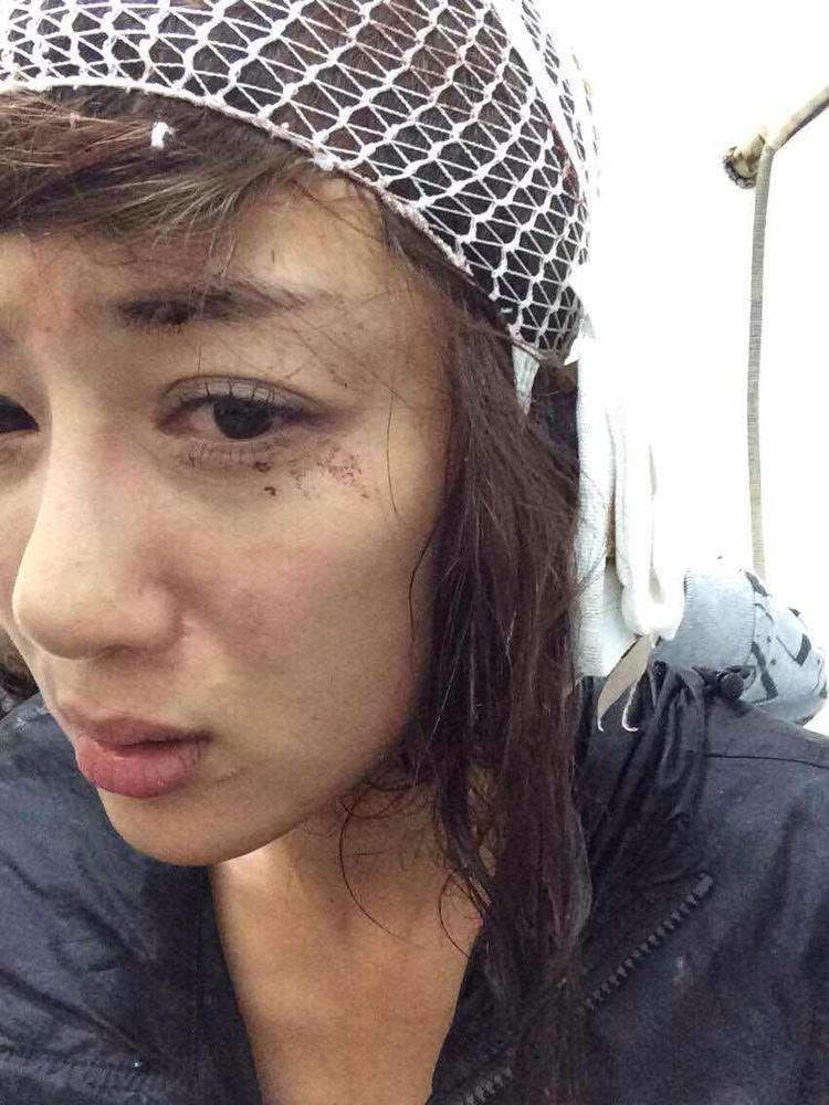 明星整容毀容最嚴(yán)重的是誰，深度探討與反思，深度探討與反思，哪位明星整容遭遇最慘重的毀容？