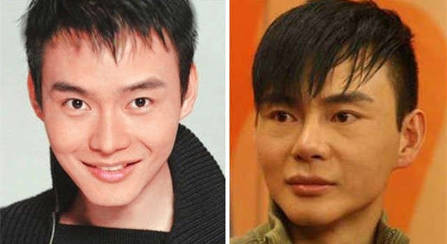 整過容的男明星名單，揭秘娛樂圈的顏值變革之旅，揭秘娛樂圈顏值變革之旅，整過容的男明星名單曝光
