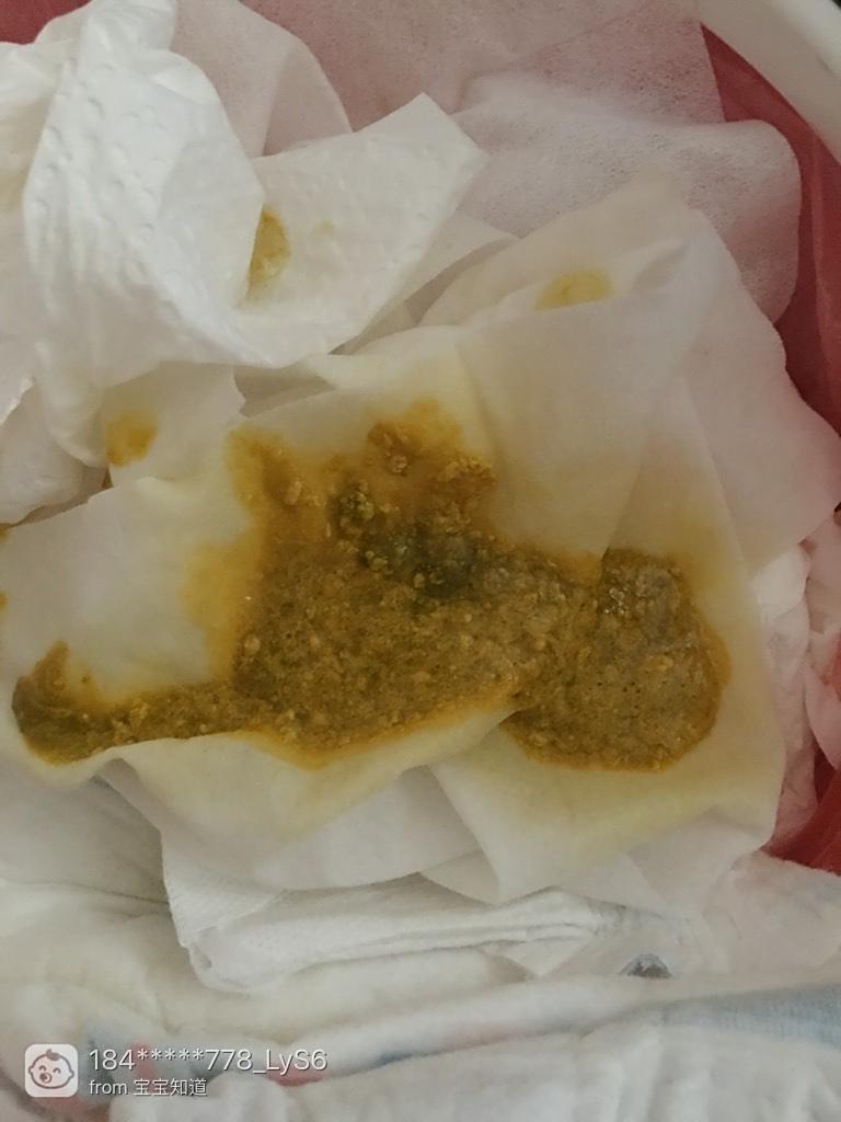 關于4個月的寶寶拉肚子怎么辦的全方位指南，4個月寶寶拉肚子應對指南，全方位解決方案